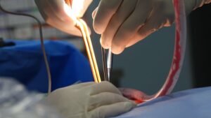effective methods for frequent complications